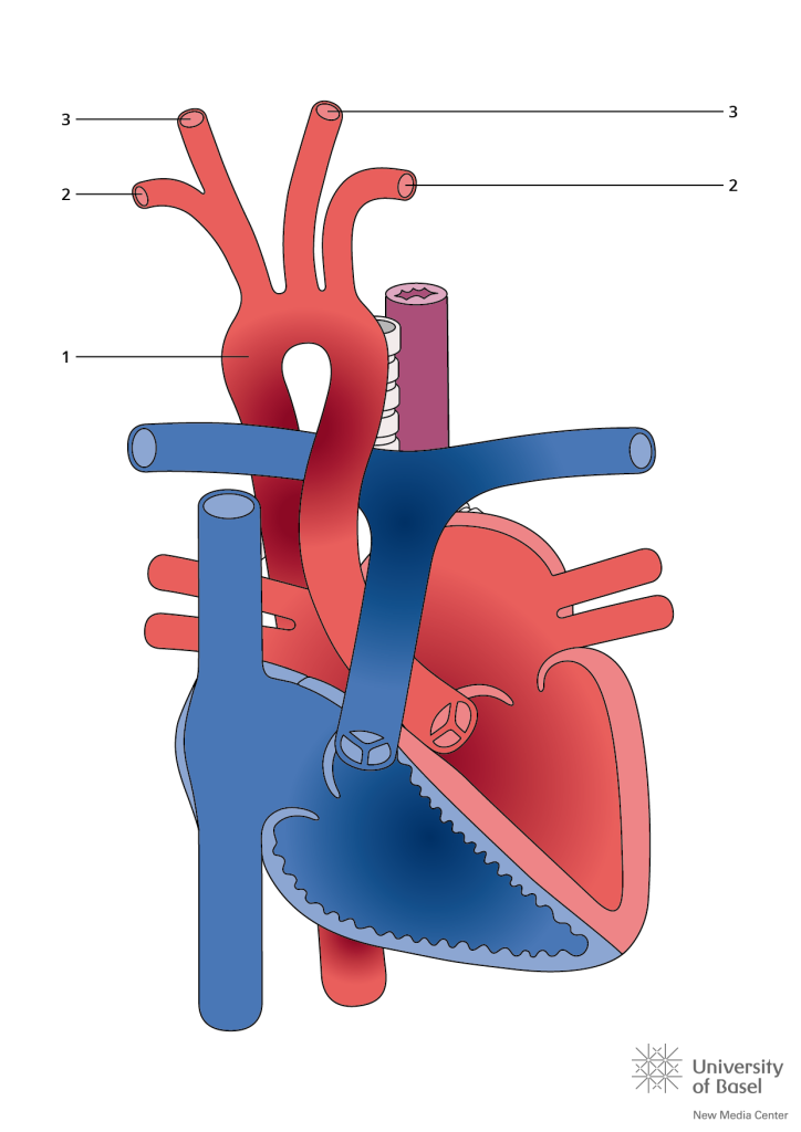 HOÁN VỊ ĐẠI ĐỘNG MẠCH CÓ SỬA CHỮA